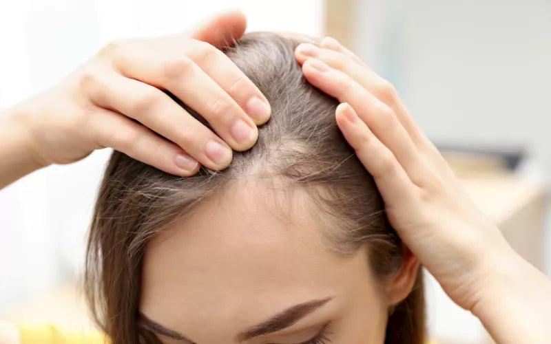 THINNING HAIR AND HAIR LOSS IN WOMEN
