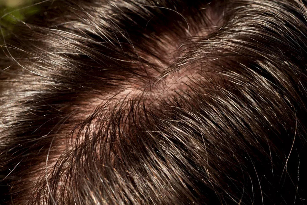 DO YOU SUFFER FROM OILY HAIR OR AN OILY SCALP?
