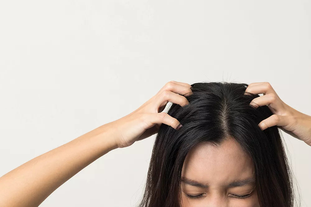 TIPS FOR A SENSITIVE, IRRITATED AND ITCHY SCALP