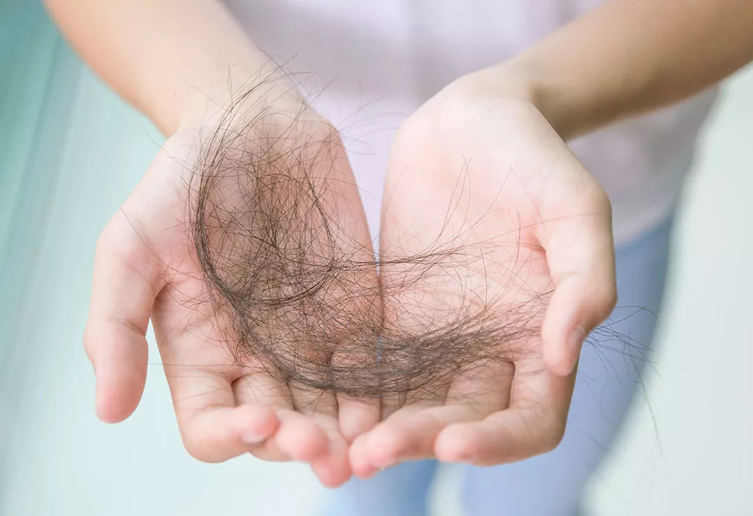 TELOGEN EFFLUVIUM: HAIR LOSS DUE TO STRESS
